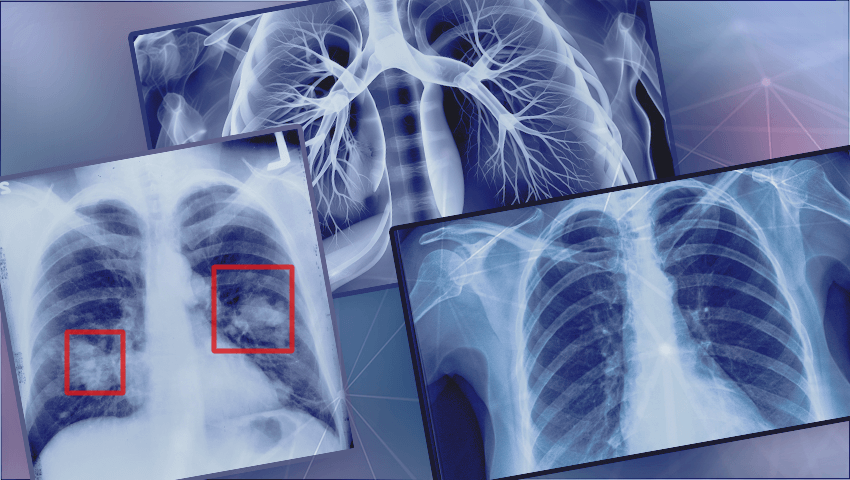 AI tool enhances transparency in X-ray analysis